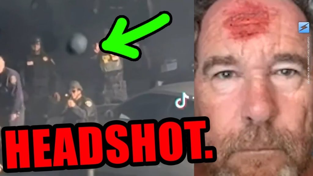 Rioter takes rubber bullet to the FACE lol